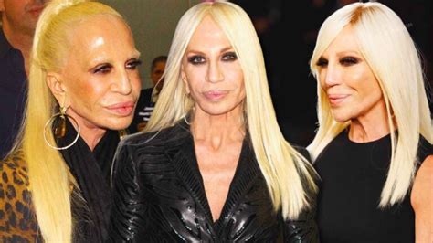 donatella versace e compagno|donatella versace face what happened.